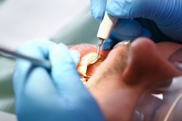 Best Urgent Tooth Repair  in Basking Ridge, NJ